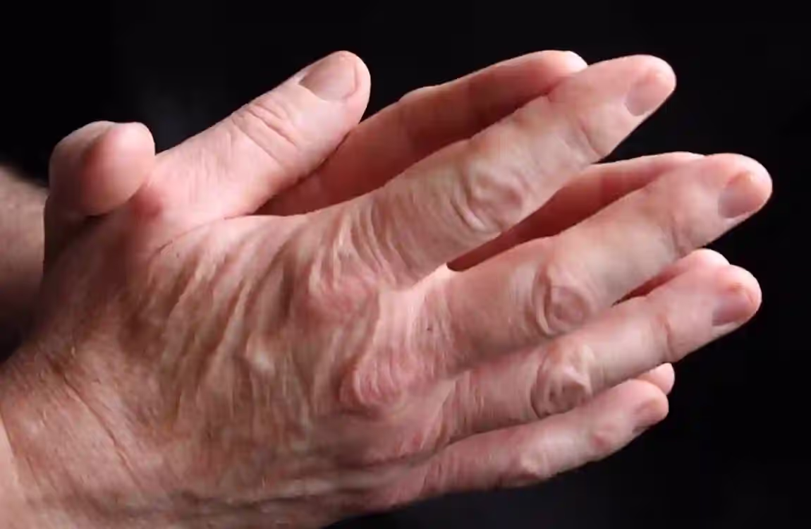 treatmentforra.space